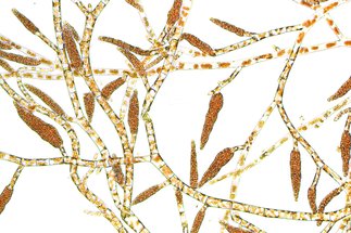 Ectocarpus under a microscope