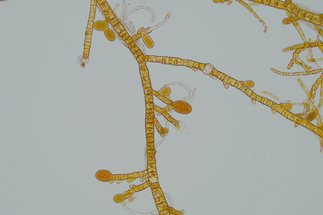 Mechanisms driving the interaction between marine virus and brown algae 