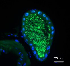 Florescence in situ hybridization micrograph illustrating the localization of pectinolytic symbionts within the symbiotic organ of Conistra rubiginosa.